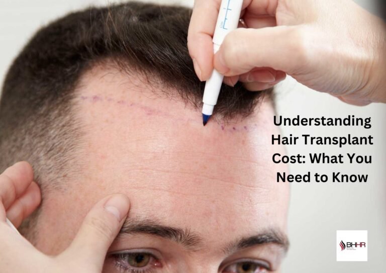 Understanding Hair Transplant Cost: What You Need to Know